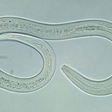 AccuElis Strongyloides stercoralis Detection Kit