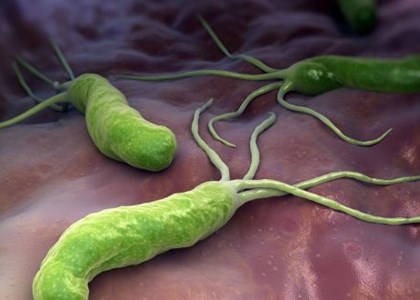 AccuLite H. pylori Genotyping Kit