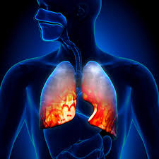 FTD Respiratory pathogens 33